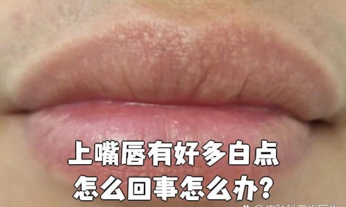 恶露期间可以做头了吗-恶露期间能做提肛运动吗网 | 恶露不尽能做提肛运动吗,恶露期间能做提肛运动吗女